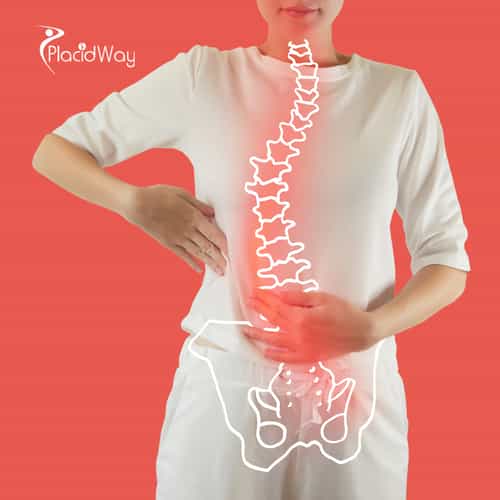 Minimally Invasive Spine Surgery in Turkey for Frankfurt Patients 